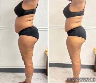 Body Sculpting by Crystal Mack at Glam Therapy