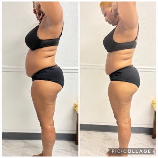 Body Sculpting