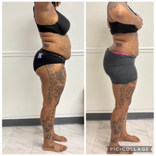 Cosmetic Post-Op Recovery