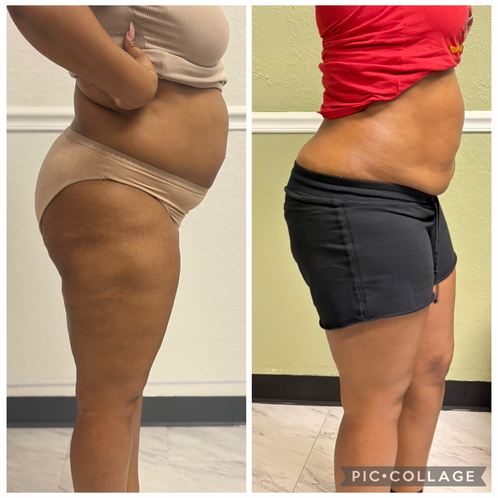 Home 10 Body Sculpting