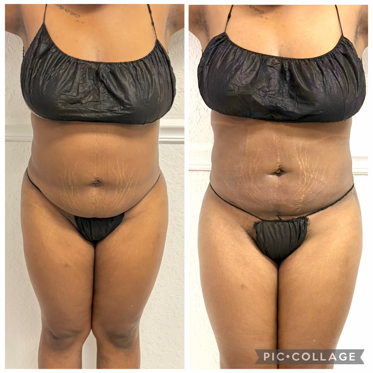 Home 14 Manual lymphatic drainage glam therapy